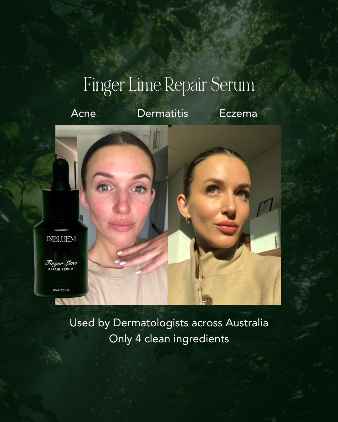 Finger Lime ~ Repair Serum