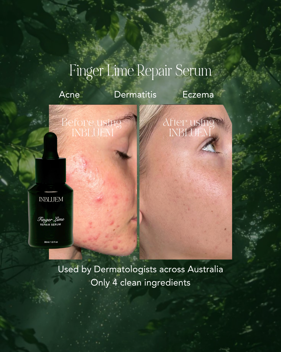 Finger Lime ~ Repair Serum